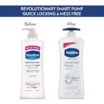 Vaseline Derma Care Advanced Repair Body Lotion|| For Sensitive|| Dry Skin|| Non Greasy|| Long Lasting Moisturisation|| 400 ml - Image 4
