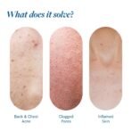 Be Bodywise 2.5% Benzoyl Peroxide Body Wash | Fights Severe Back & Body Acne | Kills Acne Bacteria, Unclogs Pores & Prevents Breakouts | With Aloe Vera & Glycerin | Dermatologist-Tested | 250ml - Image 2