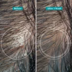 Australian Tea Tree Hair Shampoo for Dandruff|Itchy Scalp|Men and Women (AA1104/233) - Image 3