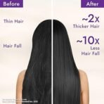 Parachute Advansed Rosemary-enriched Coconut Hair Oil| Rosemary Hair Oil| Superfoods Magic| Long & Thick Hair|300 Ml (AA1104/170) - Image 3