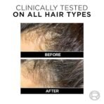 L'Oreal Paris Anti-Hair Fall Shampoo, Reinforcing & Nourishing for Hair Growth, For Thinning & Hair Loss, With Arginine Essence and Salicylic Acid, Fall Resist 3X, 340ml - Image 5