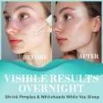 Repechage Acne Spot Corrector Hydra Medic Clear Complexion Drying Lotion | Active Acne & Pimple | Suitable for Oily & Acne Skin 7.5ml.[AA1098/83] - Image 2