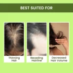 Alps Goodness Rosemary Water Refill Pack (305 ml) | Boosts Hair Growth | Viral Rosemary Water | Reduces Hair Fall | Hair Spray for Hair Growth | Hair Growth Serum[AA1098/33] - Image 3